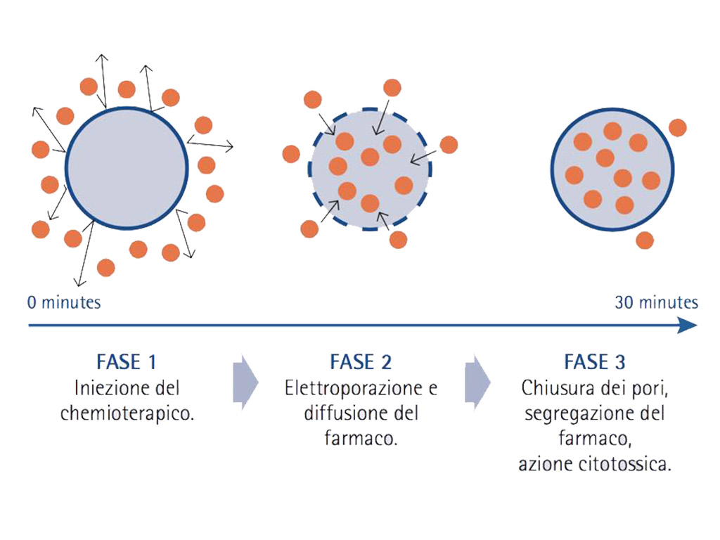 Elettrochemioterapia