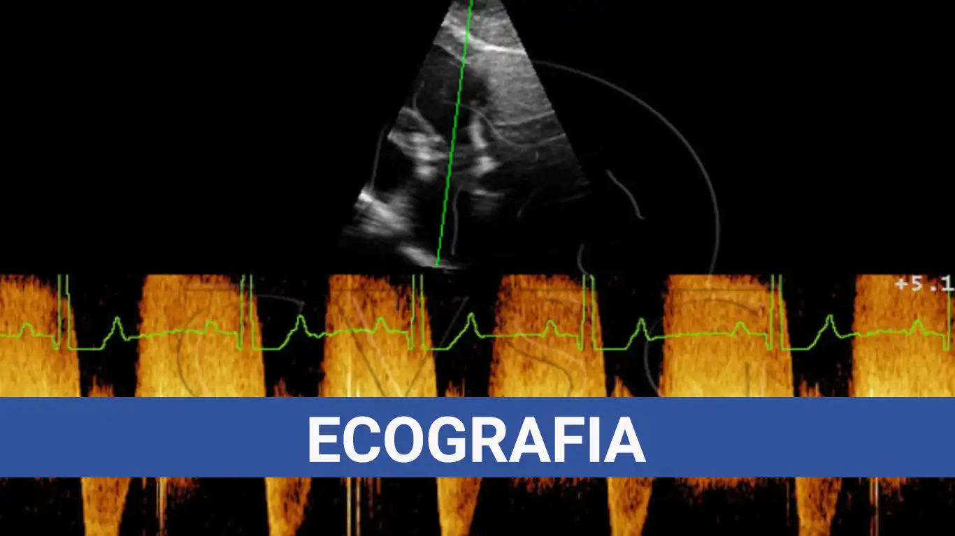 Ecografia