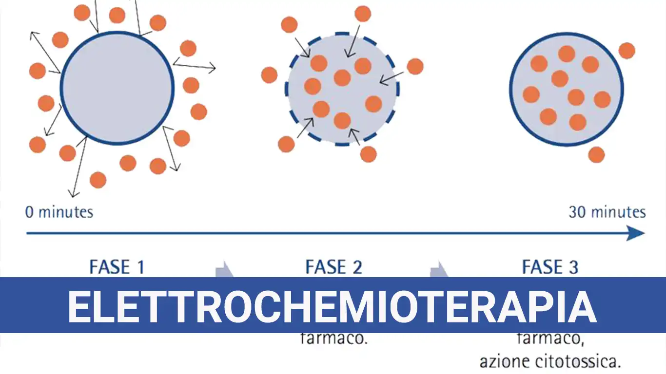 Elettrochemioterapia