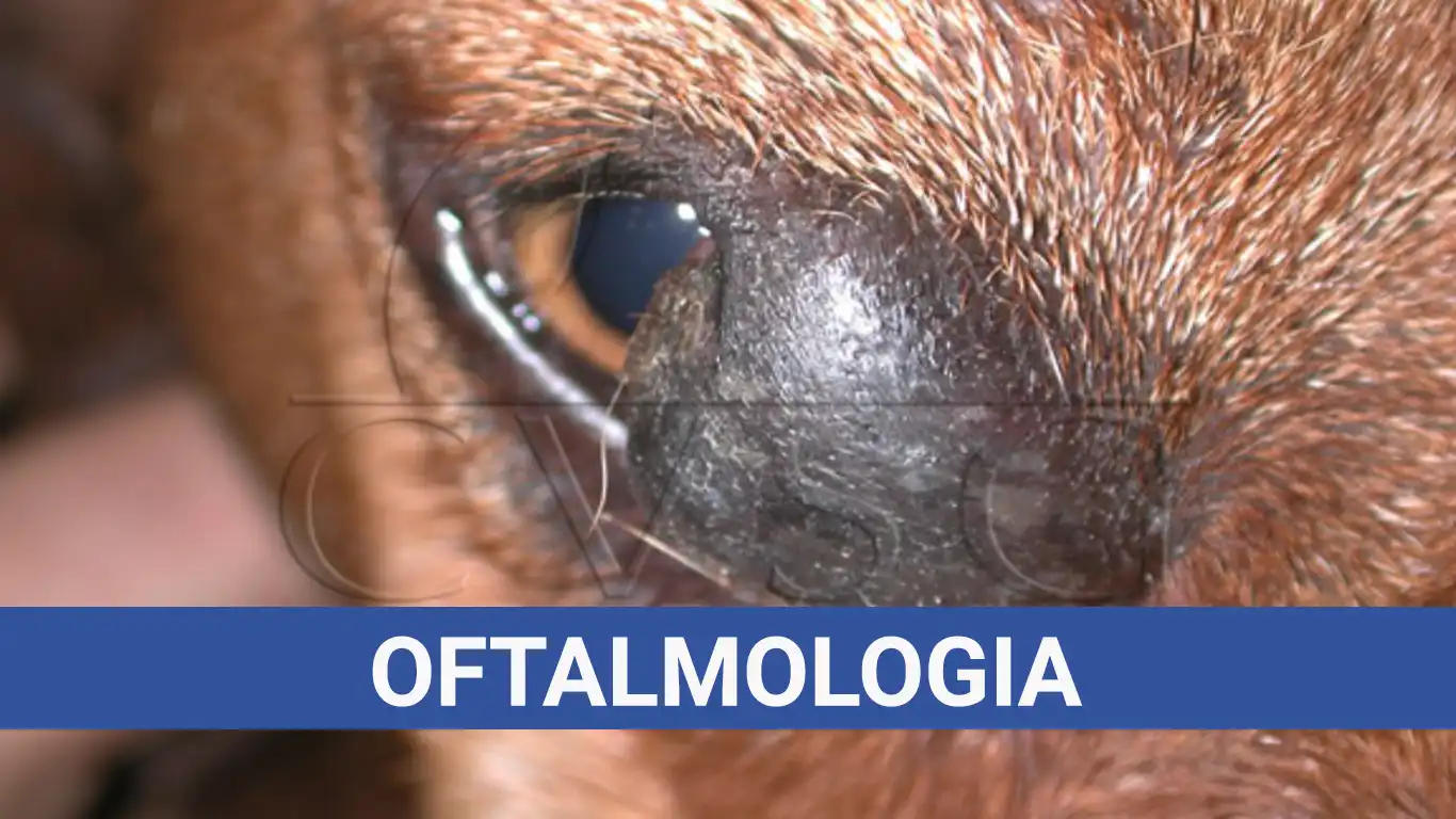 Oftalmologia