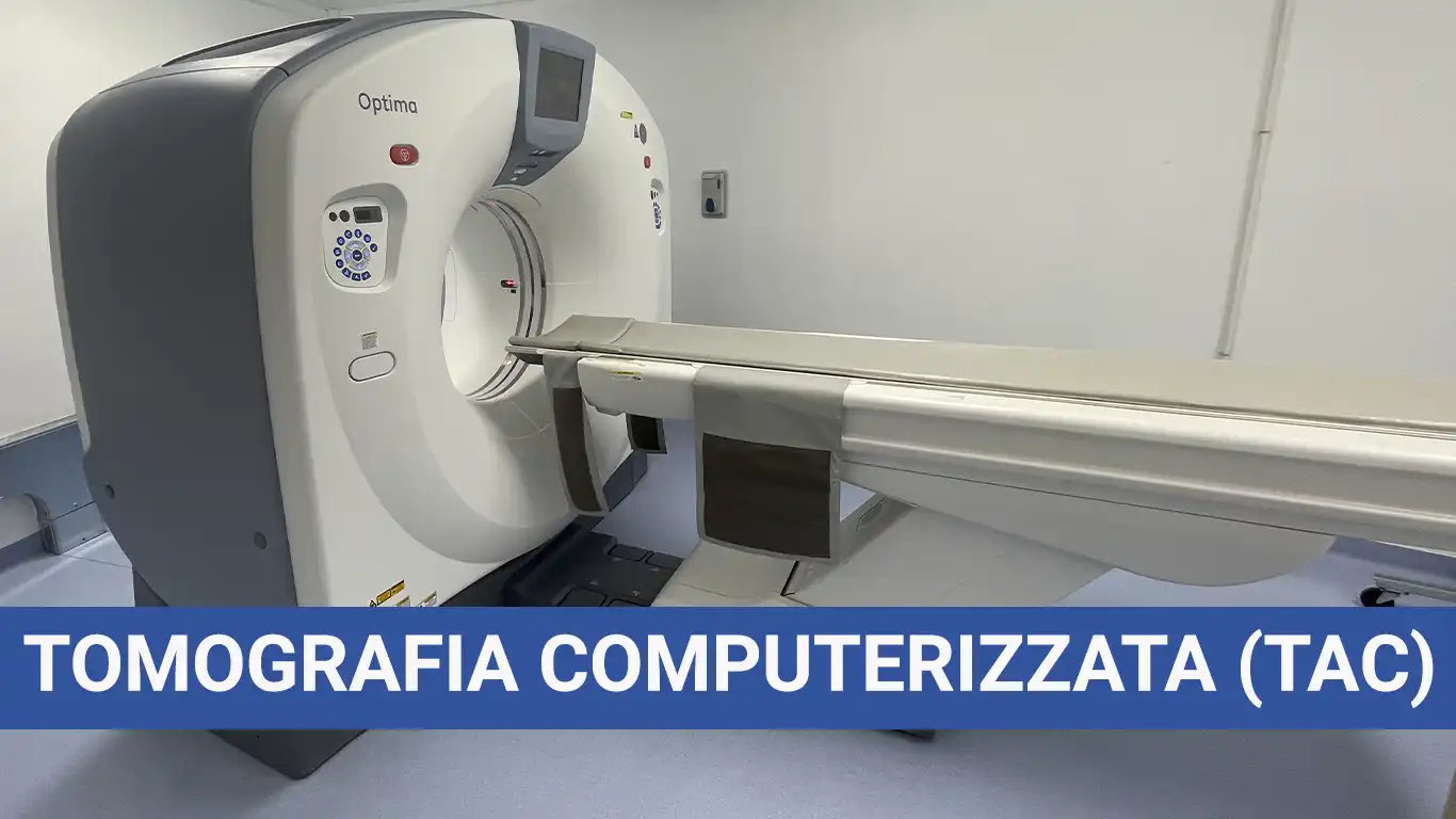 Tomografia Computerizzata (TAC)